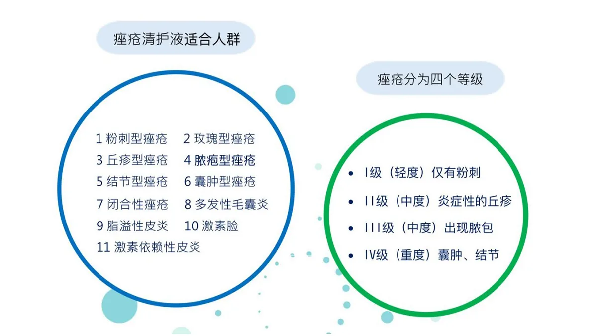 痤疮适合人群与四个等级